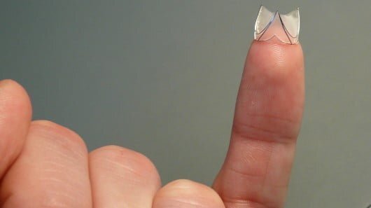 Inventie revolutionara. Au aparut venele artificiale